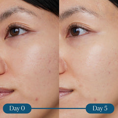 Facial Serum Elemis Dynamic Resurfacing 30 ml - Elemis Maroc - Aylal Beauty